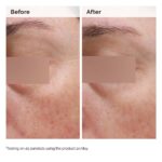Niacinamide 5% Face and Body Emulsion Results